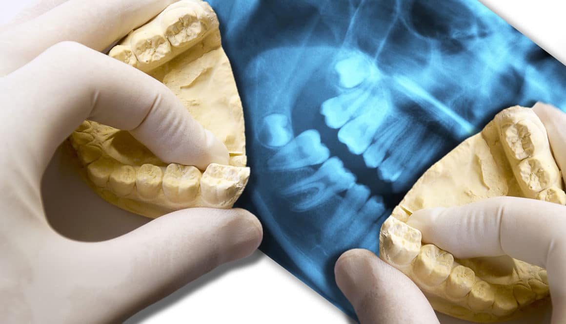 Osteopatia odontoiatrica